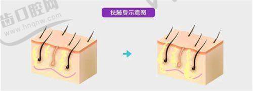 张楚医生的技术实力：不是靠营销，而是靠硬实力