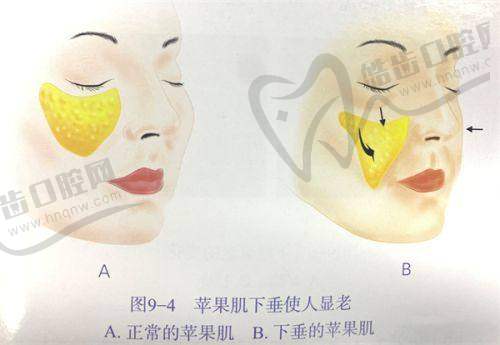 张楚价格真相：贵但有贵的理由