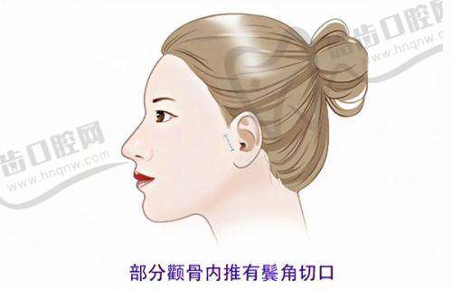 向平医生坐诊的海口红妆尚医学美容医院详情