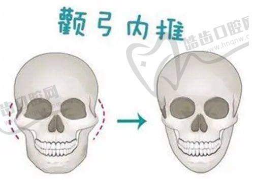 刘凯医生预约挂号