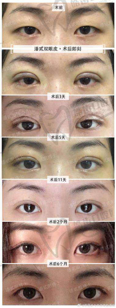 二、彭喜医生擅长项目