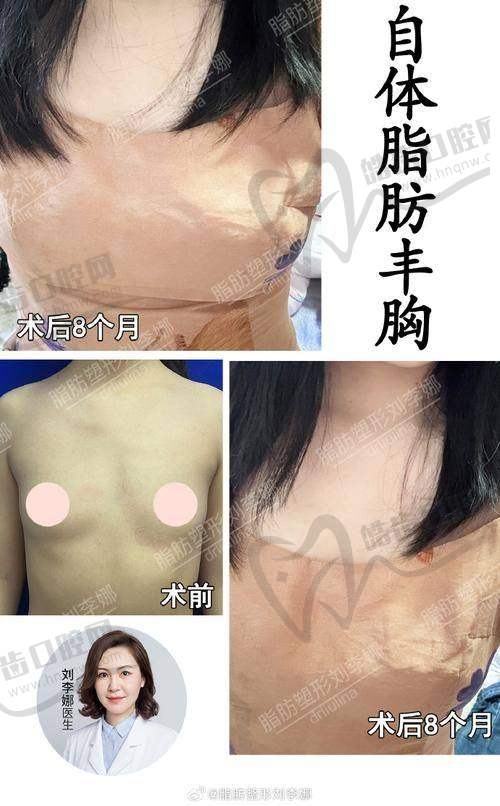 哈尔滨美联致美整形医院价格表