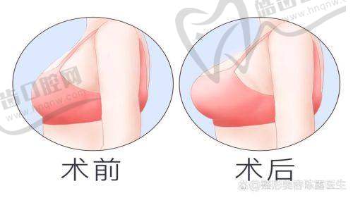 上海愉悦薇莱医疗美容医院收费价格表/收费标准