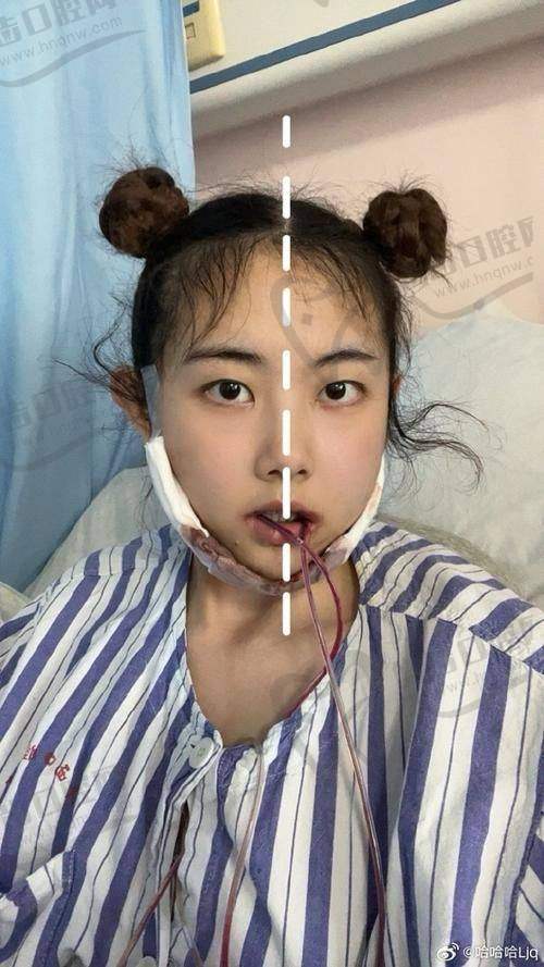 朱荣文医生技术水平高
