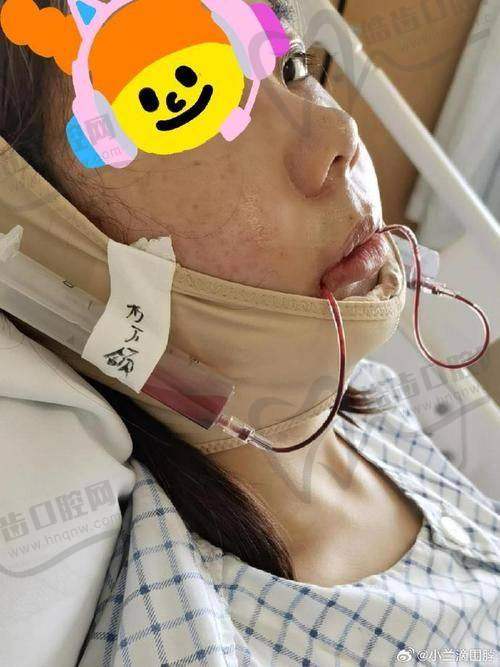 朱荣文医生预约挂号