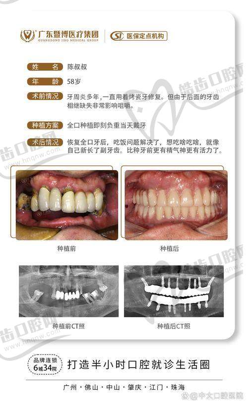 深圳美莱口腔周炜医生坐诊医院