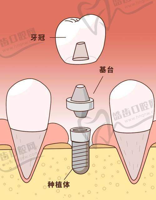 深圳和贝口腔门诊部怎么样？