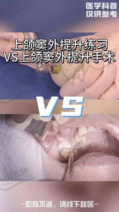 深圳河山口腔诊所(固戍店)地址电话