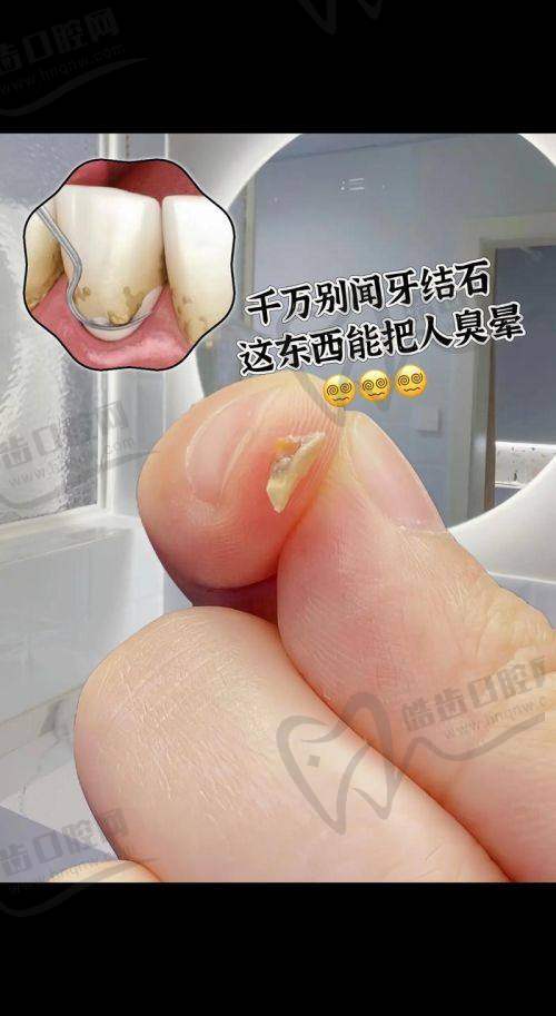 深圳正恩口腔(罗湖总店)地址电话
