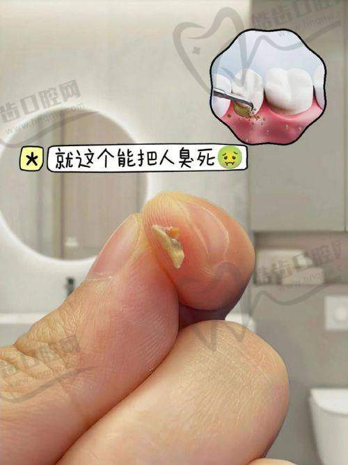 深圳河山口腔诊所(固戍店)诊疗项目