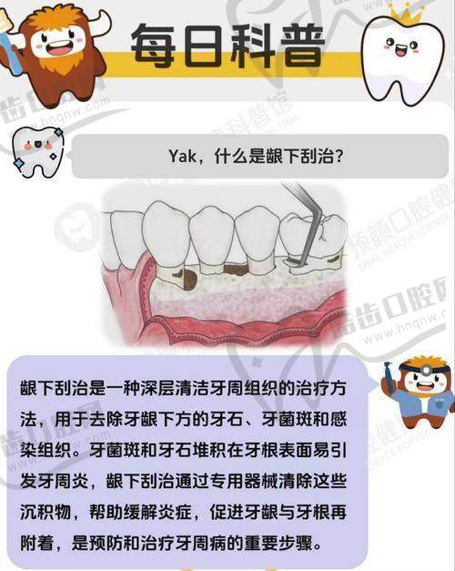 金华金东金瓯口腔门诊部种植牙怎么样？