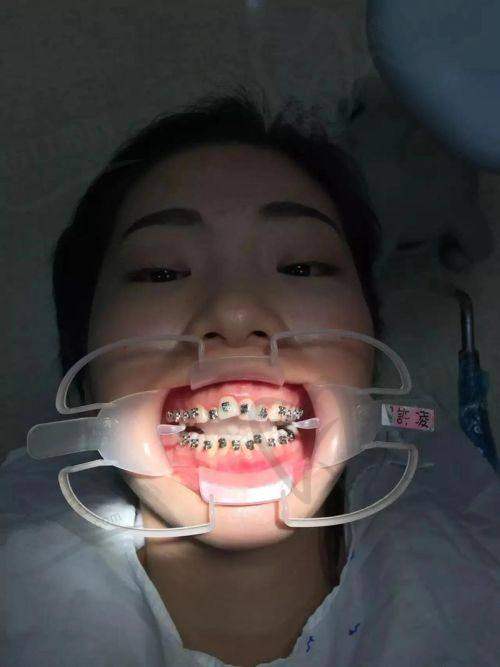 深圳美莱口腔周炜医生技术优势