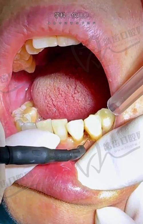 深圳弘意口腔(HALO广场桃园路)怎么样？