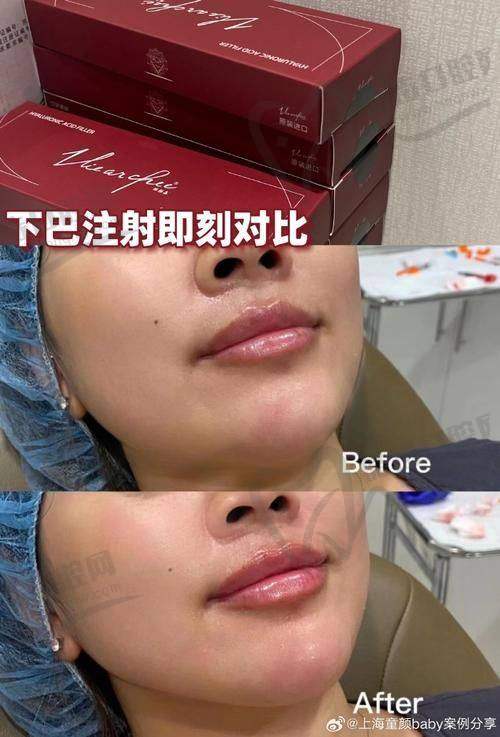 黄俊超医生预约挂号