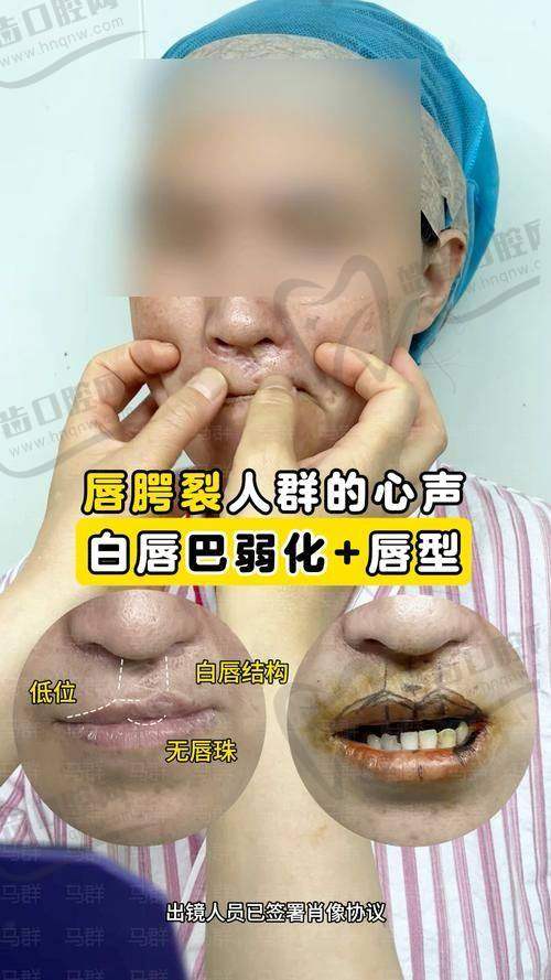 田孝臣医生口碑评价及反馈内容