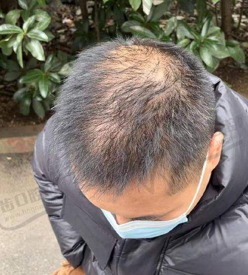 二、梁明成医生擅长项目