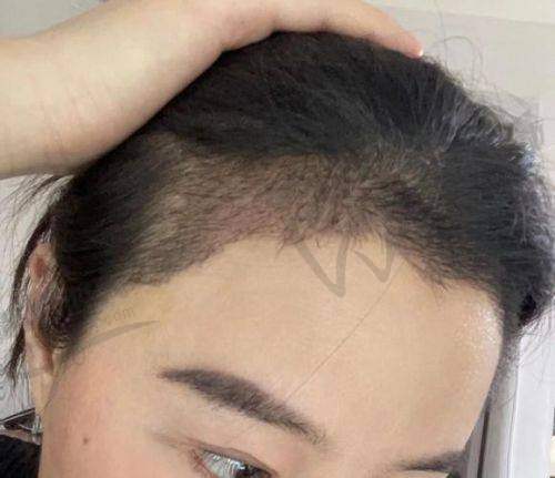哈尔滨美联致美整形医院项目特色