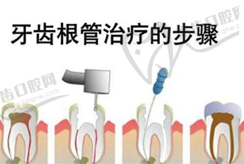 王伟医生的技术优势