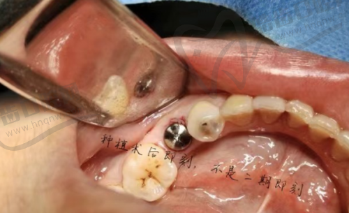 周志栋医生的个人资料简介