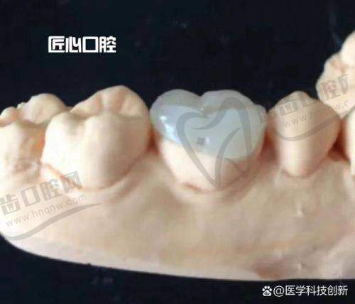 王伟医生的擅长项目