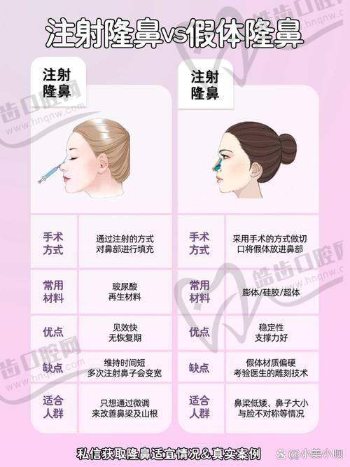高性价比：上海岳伟骨雕鼻的显著特点