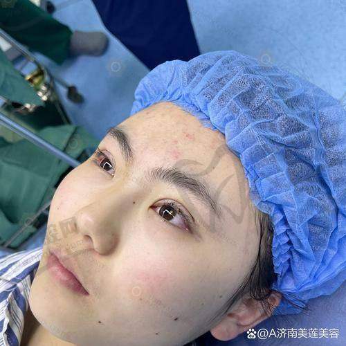 刘开文医生做手术价格