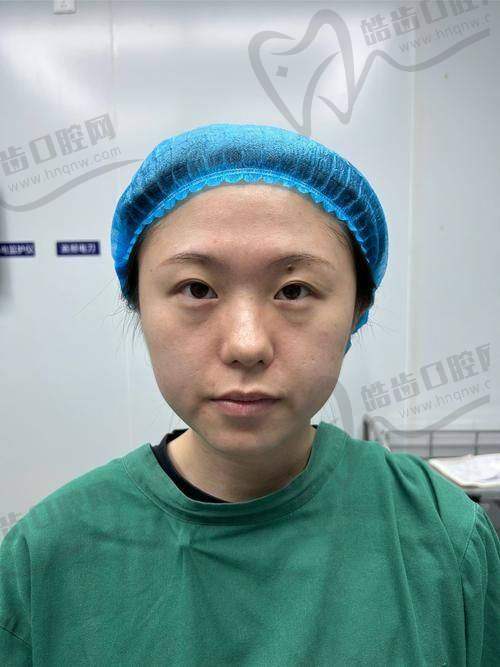 刘开文医生顾客实例图片
