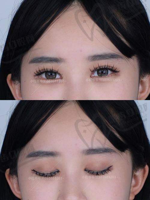 杨存昌医生口碑如何