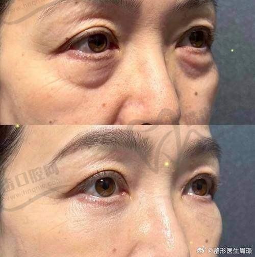 孔令伟医生怎么挂号