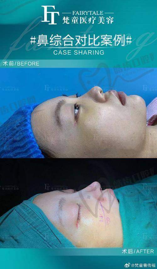 郑州顺美医疗整形医院价格表
