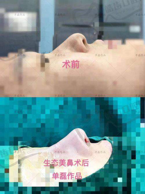 郑州华领医疗美容医院张涵医生怎么挂号