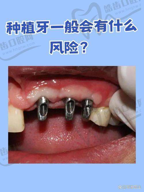 2025就诊攻略:3种预约方式+避坑指南,看牙不踩雷