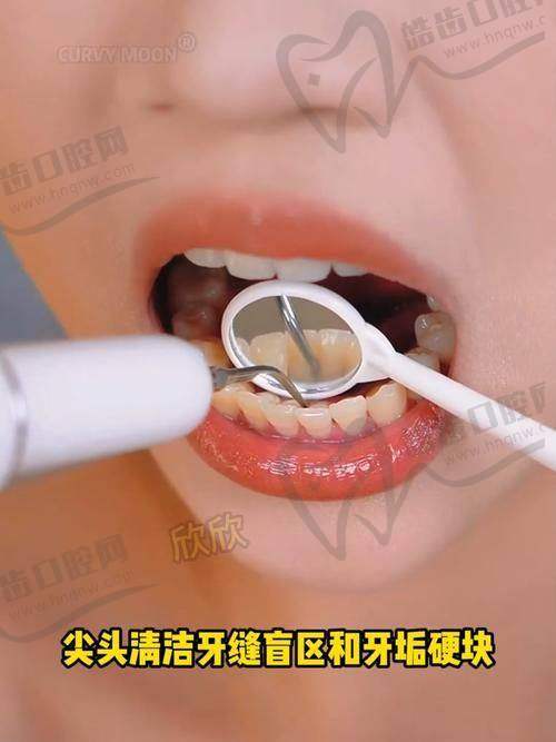 【惠州深惠口腔跟惠州口腔】2025哪家更靠谱？评价对比+地址电话全公开|种牙价格实惠！