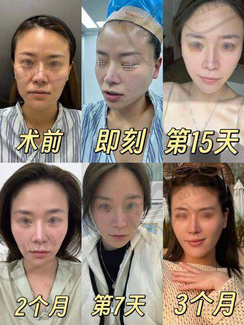 杨存昌医生属于什么级别