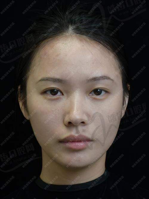 杨存昌医生的价格情况
