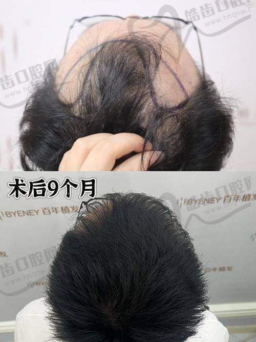 郑州顺美医疗整形医院医生简介