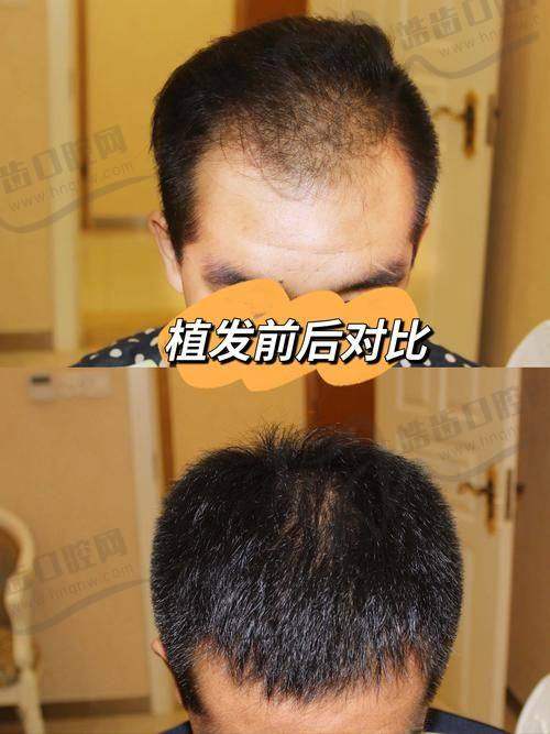 郑州华领医疗美容医院张涵医生的任职经历和荣誉与成就