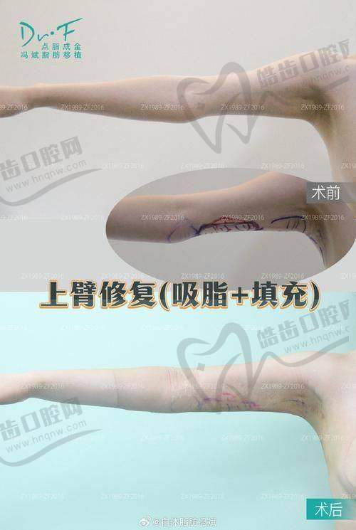赵军舰医生坐诊时间有变，附北京奥尔贝德最新坐诊表和预约方式