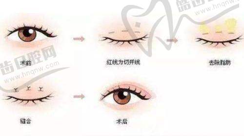 深圳清芙蓉医疗美容诊所地址电话营业时间
