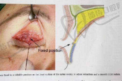 成都军大整形医院口碑咋样?正规团队、设备先进、服务获好评,抽脂骗局是谣言