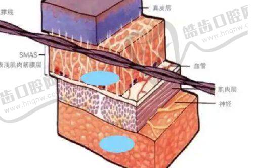 上海赛米医疗美容医院吸脂手术价格表