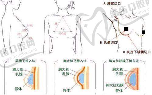 四、杭州天鑫整形國慶活動參與方式與注意事項(xiàng)