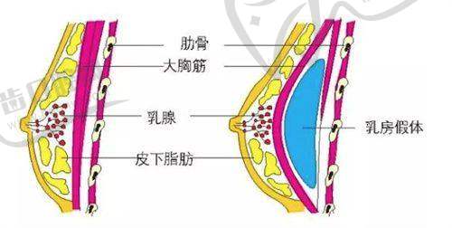 巫文云医生做手术价格