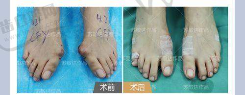 巫文云医生口碑如何