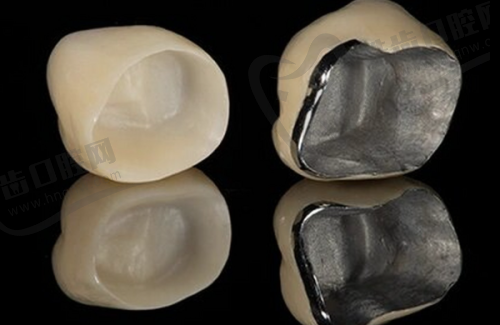 2025年香港睇牙医更新价目表大公开:牙齿美白项目有哪些收费?