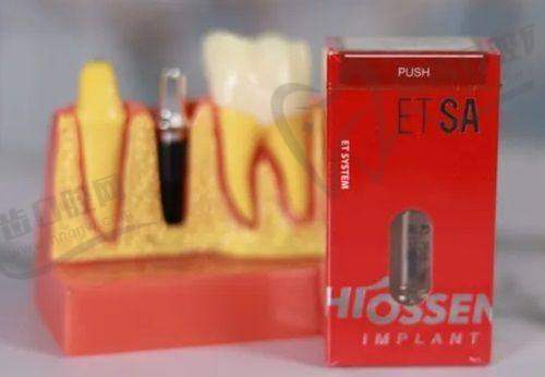 2025年香港睇牙医更新价目表大公开:牙齿矫正费用多少?