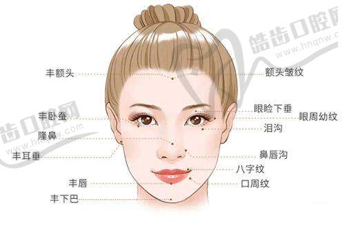 杭州不同部位玻尿酸填充价格