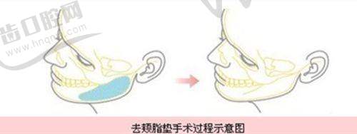 成都军大整形医院是公立还是私立?口碑咋样?项目价格表及活动福利大公开!