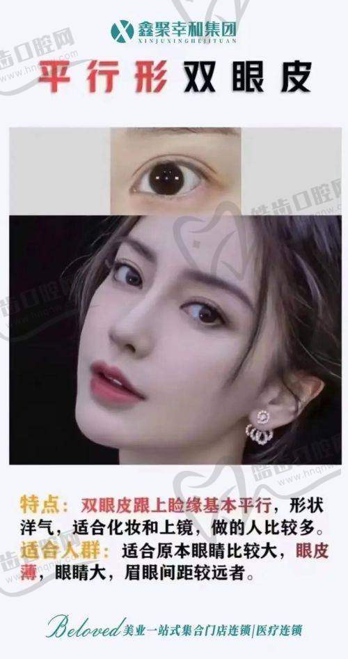 看价格看细节：成都李瑞萱双眼皮项目价格表公布
