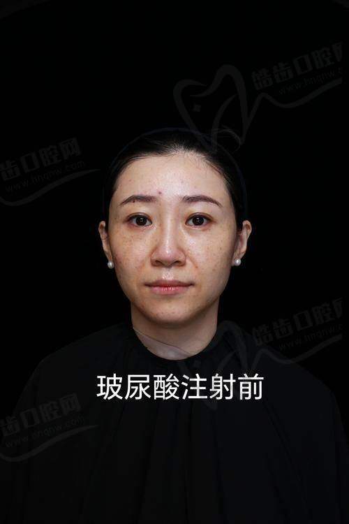 王琛医生个人简介资料
